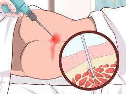 Hội chứng Fanconi - Hình ảnh minh họa